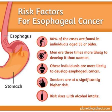 Main Factor for Rising Stomach Cancer Cases Identified