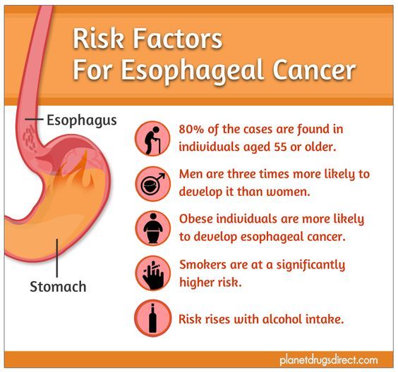 Preview Main Factor for Rising Stomach Cancer Cases Identified