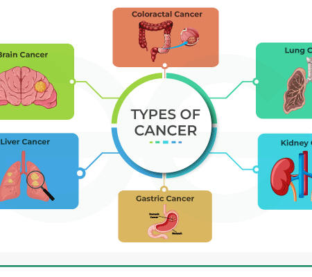 Major Breakthrough: Effective Strategy Found for Common Cancer Type