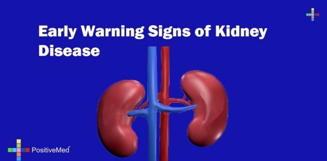 Preview Unexpected Indicator of Kidney Disease Revealed