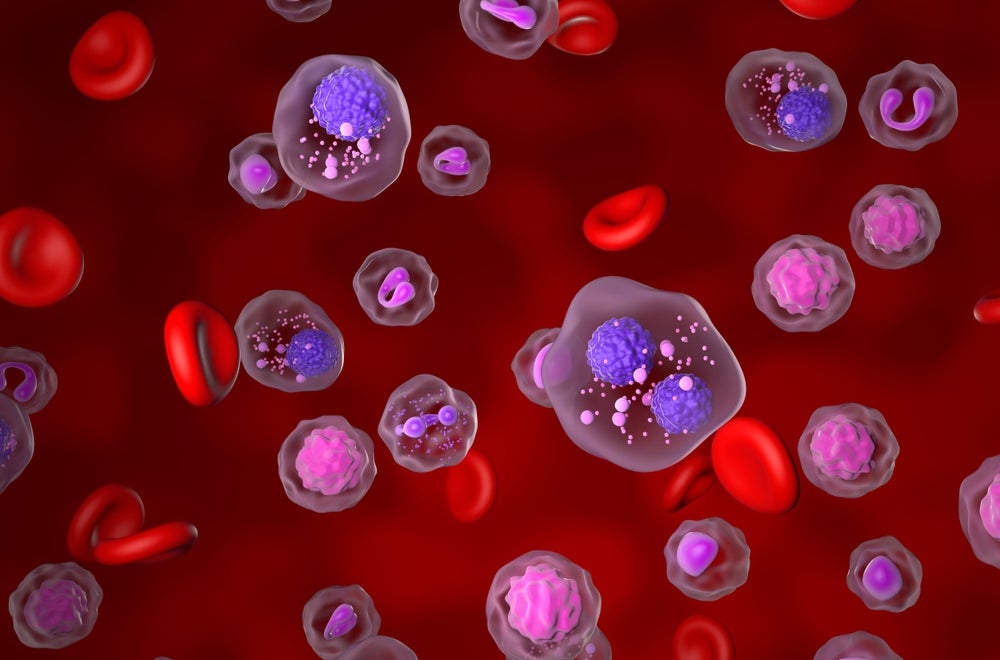 Preview A Breakthrough in Combating Resistant Tumors