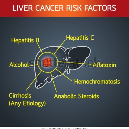 Key Factors Behind Liver Cancer Identified