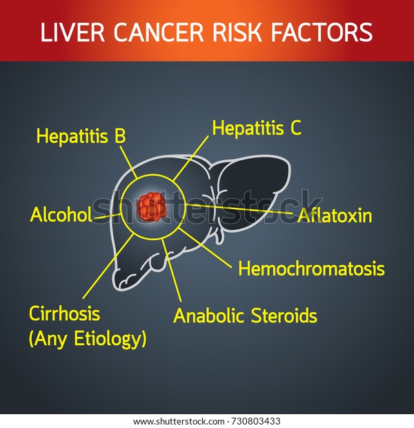 Preview Key Factors Behind Liver Cancer Identified