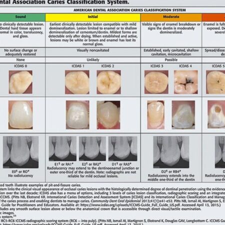Breakthrough in Early Detection of Dental Caries: A New Predictive Method