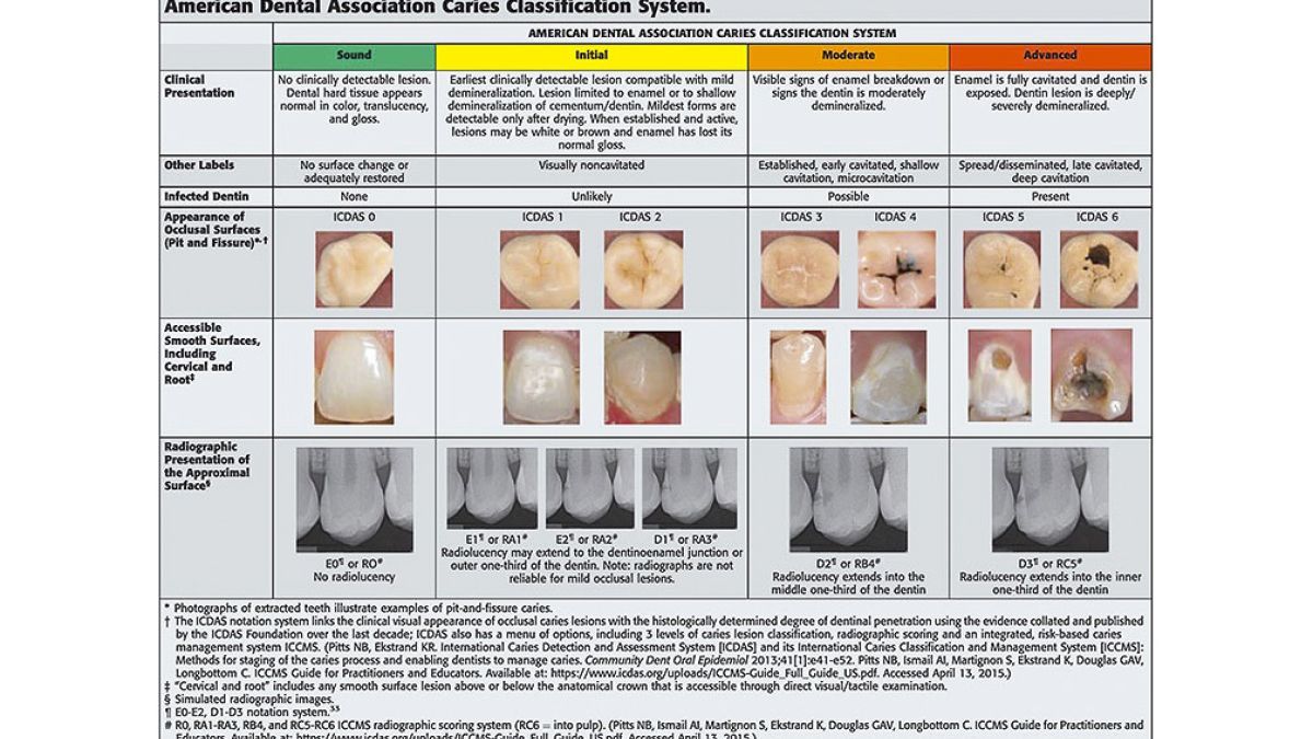 Preview Breakthrough in Early Detection of Dental Caries: A New Predictive Method