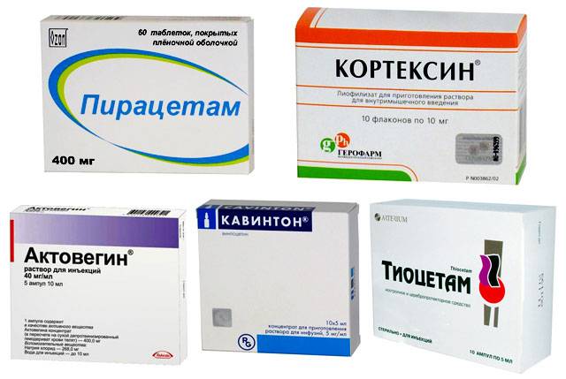 Preview Революционный препарат для спасения мозга после инсульта