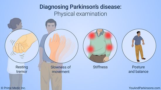 Preview Physical Activity: A Simple Path to Alleviate Parkinson’s Symptoms