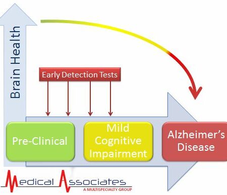 New Method for Early Detection of Alzheimer’s Disease Developed