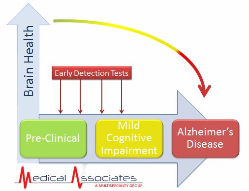 Preview New Method for Early Detection of Alzheimer’s Disease Developed