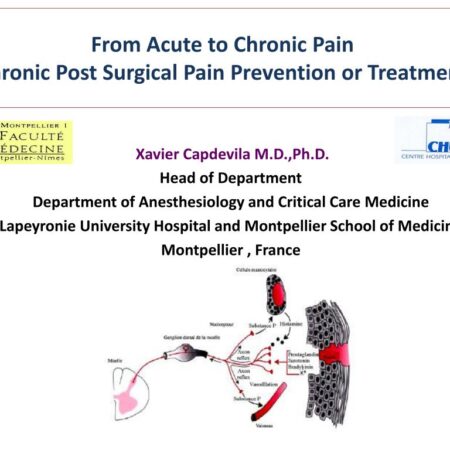 Unveiling a Hidden Factor Amplifying Chronic Pain