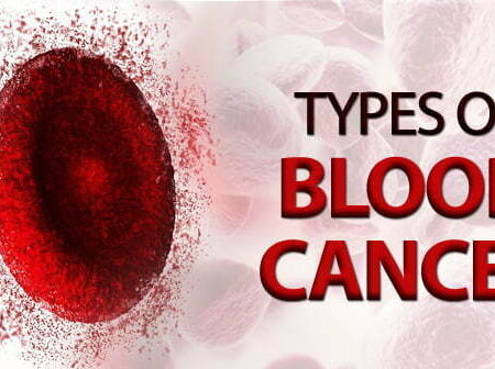 Breakthrough: Method Discovered to Halt Blood Cancer Progression