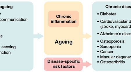 Unexpected Factor of Premature Aging Discovered