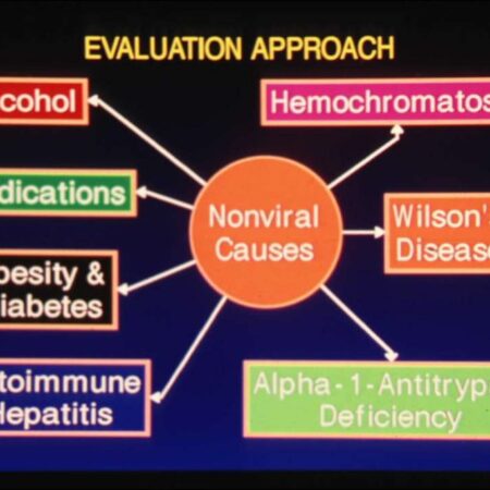 Unexpected Link Between Hepatitis B Immunity and Reduced Diabetes Risk Discovered
