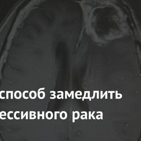 Найден новый способ замедлить рост агрессивного рака мозга