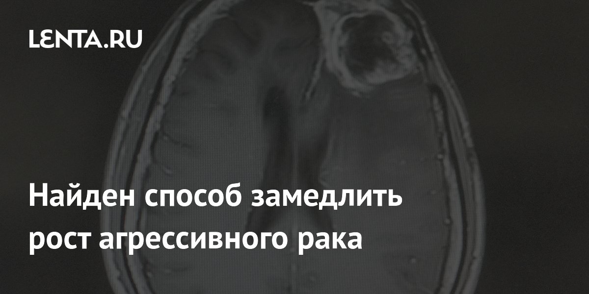 Preview Найден новый способ замедлить рост агрессивного рака мозга