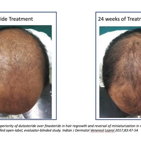 An Unexpected Factor Linked to Hair Loss