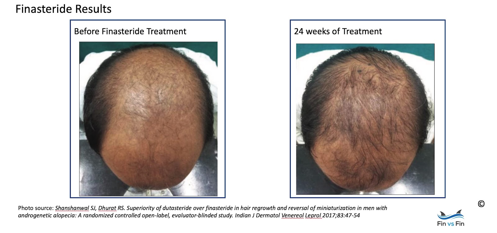 Preview An Unexpected Factor Linked to Hair Loss