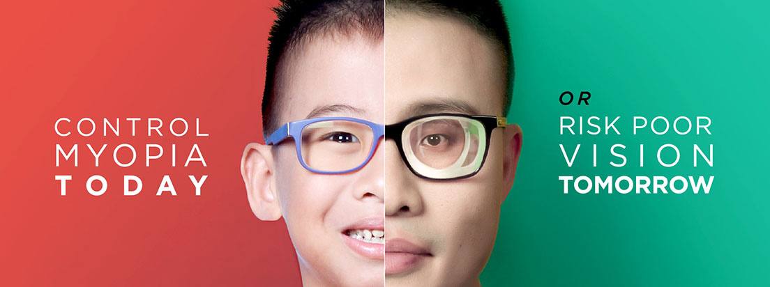 Preview Omega-3: A New Ally Against Childhood Myopia