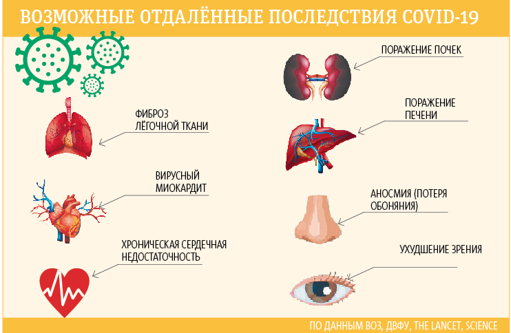 Preview Dangerous COVID-19 Aftermath Identified in Russia