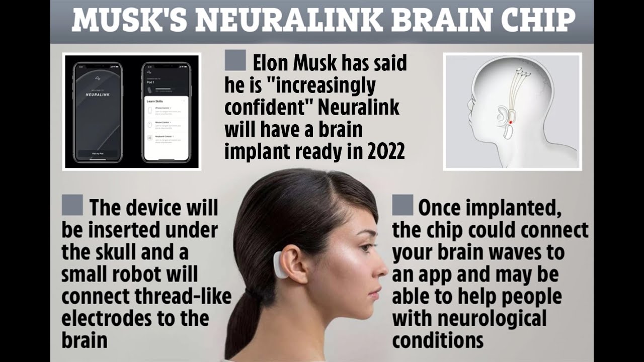 Preview Elon Musk and Neuralink: Chips for Mind Reading and Device Control