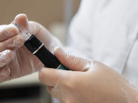 Неожиданный побочный эффект «Оземпика» и GLP-1: выпадение волос