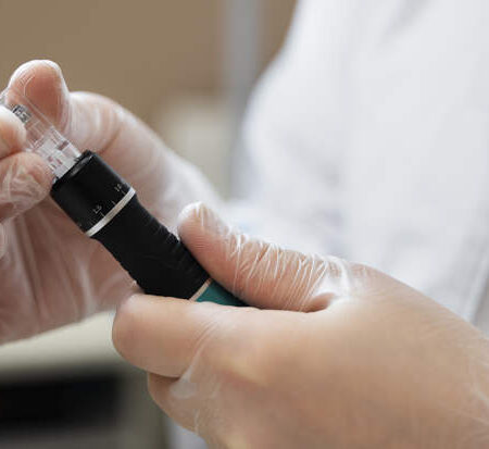 Неожиданный побочный эффект «Оземпика» и GLP-1: выпадение волос