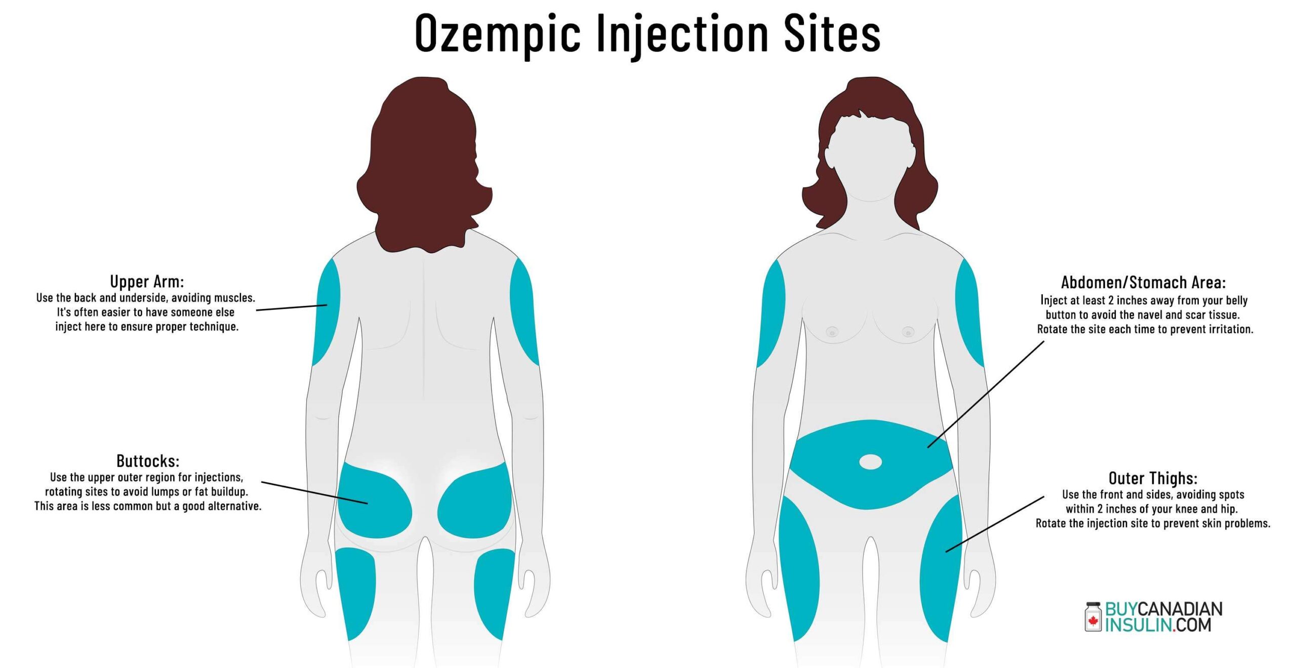 Preview Scientists Discover Method to Protect Muscles from Ozempic’s Side Effects