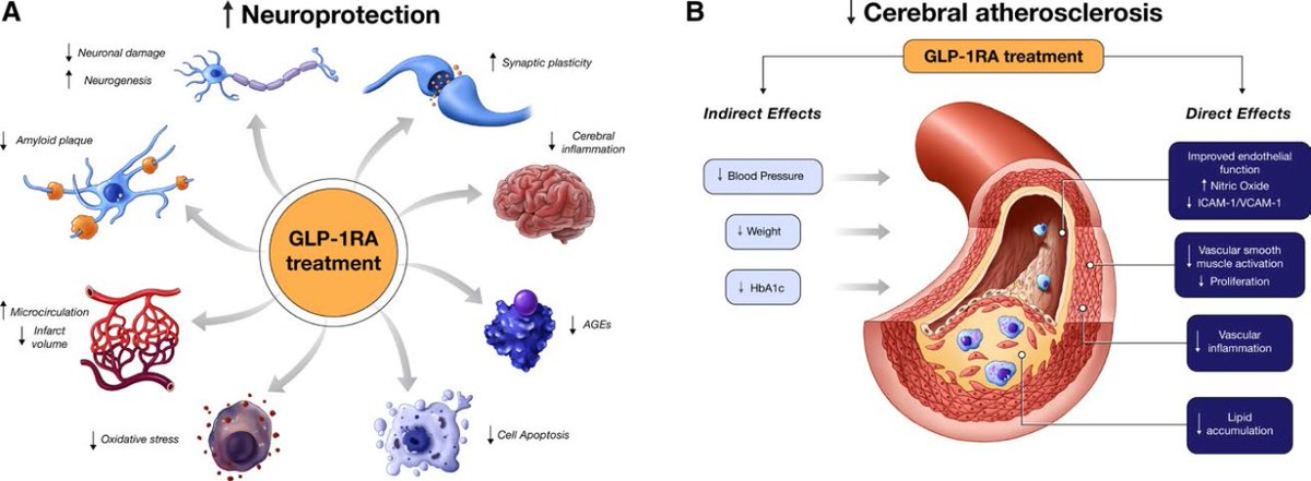 Preview GLP-1 Agonists: A New Challenge for Oncological PET-CT Diagnostics