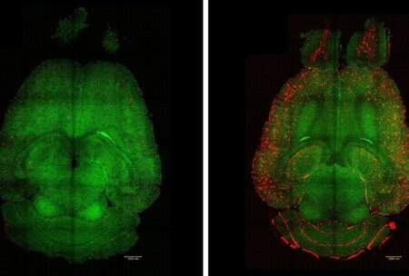 Ученые Обратили Болезнь Альцгеймера Вспять с Помощью Наночастиц