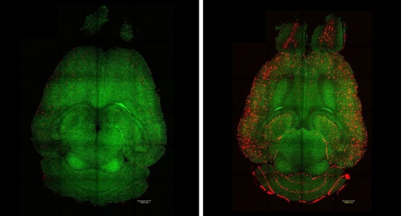 Preview Ученые Обратили Болезнь Альцгеймера Вспять с Помощью Наночастиц