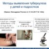 Революционный Метод: Мгновенное Выявление Туберкулеза по Воздуху