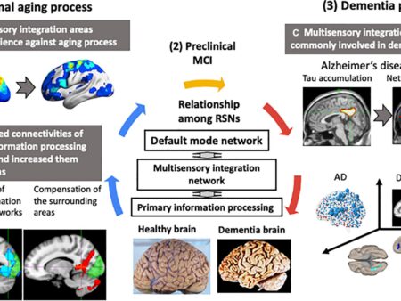 Accelerated Brain Aging Marker Identified, Linked to Anxiety
